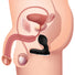 P-Swell 12x Inflatable Prostate Vibrator