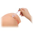 Anal - Rectum Proctoscope